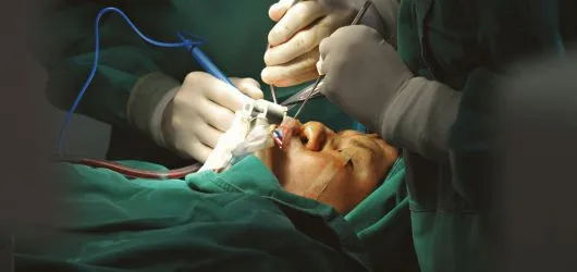 Fatores-sistêmicos-que-podem-comprometer-a-cirurgia-de-implantodontia